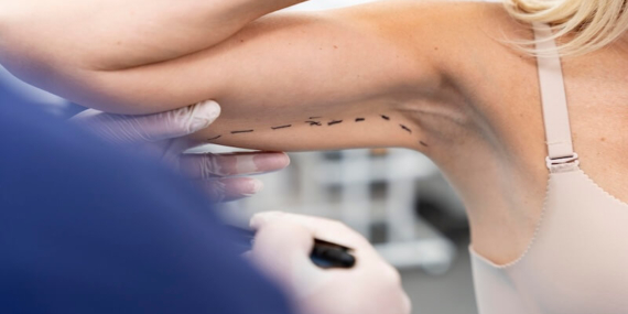 Op. Dr. Gökhan Semerci ile Kol Germe ve Uyluk Germe: Estetikte Yeni Dönem